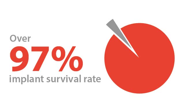 Dentium Implants Over 97% Implant Survival Rate